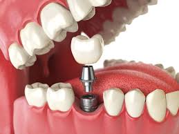 Dr. Tisa's Dental House Vaikom